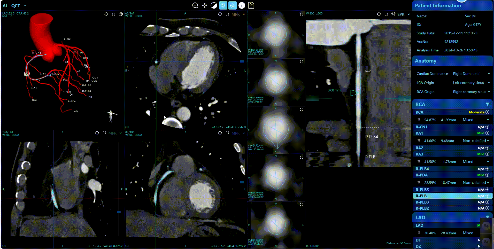 CT-Suite™  AI-QCT
